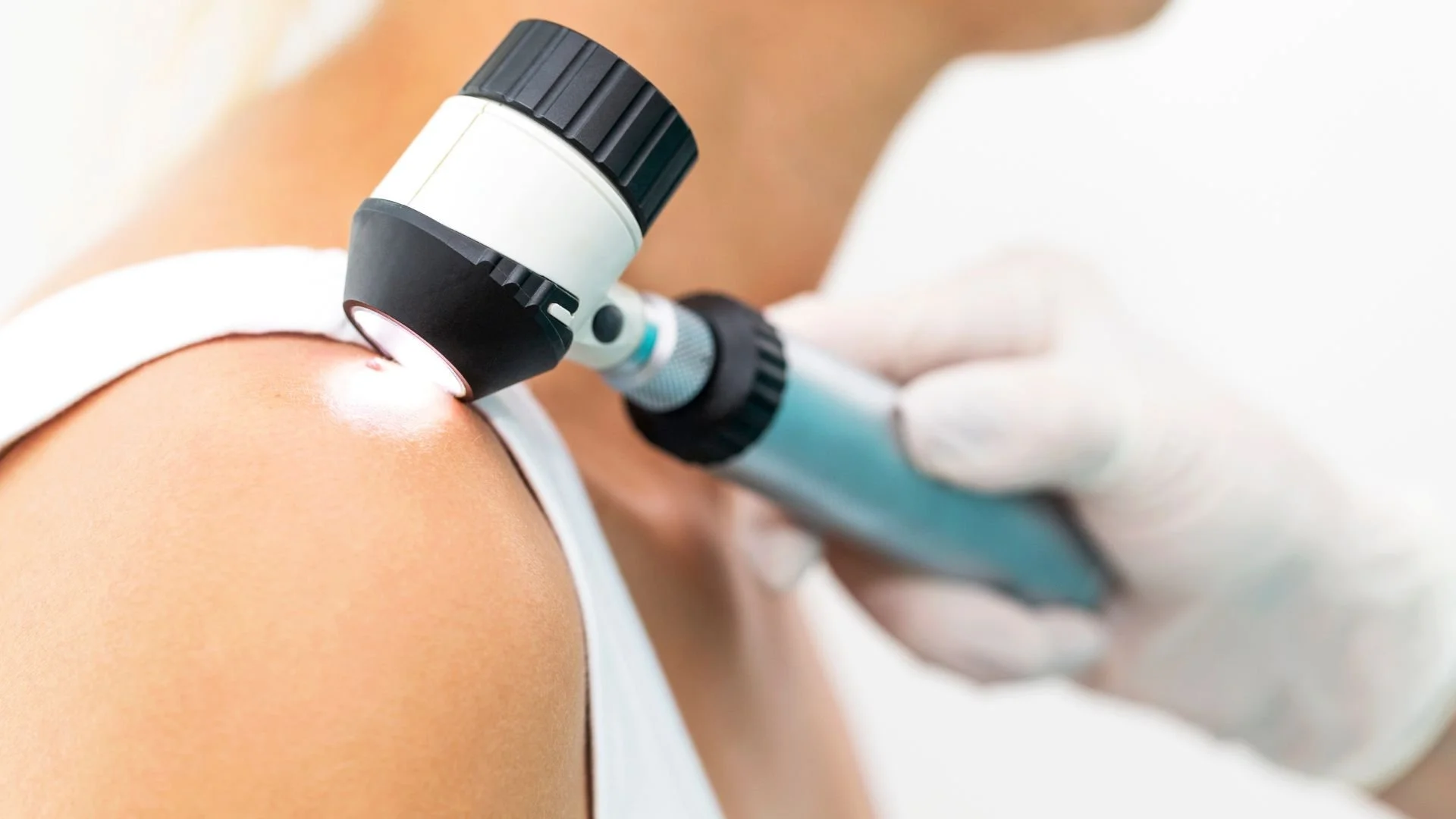 What Happens During a Full Body Skin Cancer Check?