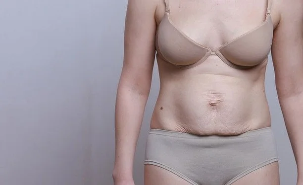 Being pregnant and giving birth has changed my body permanently, in ways that I still don’t even realize. The most obvious one is the cesarean scar across my lower abdomen and the slight pooch it has created - though I have to say, the surgeon did a fantastic job at leaving my tattoo alone.⁣
⁣
⁣
How has having kids changed your body permanently?⁣
⁣
#postpartum ⁣
#motherhood #bodyafterbaby #pregnancy #postpartumjourney #postpartumbody #mama #motherhoodunplugged #uniteinmotherhood #motherhoodrising #itsworthit