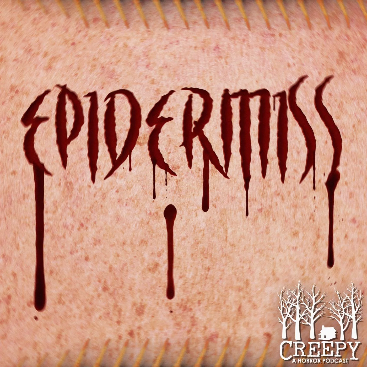 Epidermiss