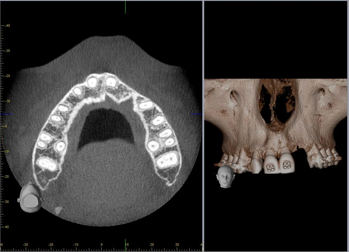 cbct2_image.jpg