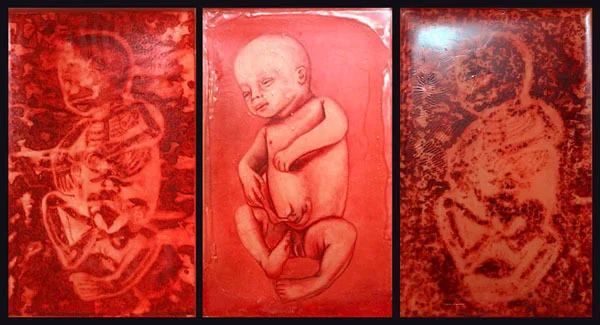 In the Womb: 36 Weeks