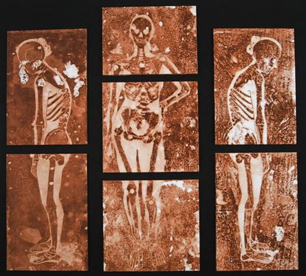 Osteoporosis Altarpiece