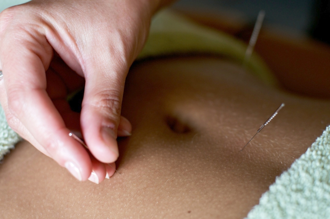 Acupuncture and Fertility