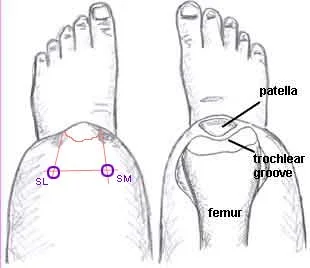 Knee-Tracking-Issues.jpg