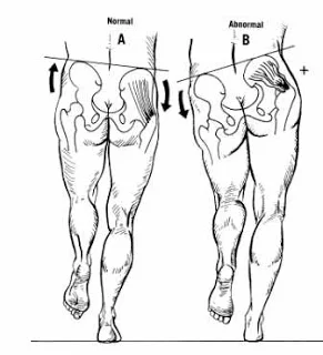 hipabductiondrawing.jpg