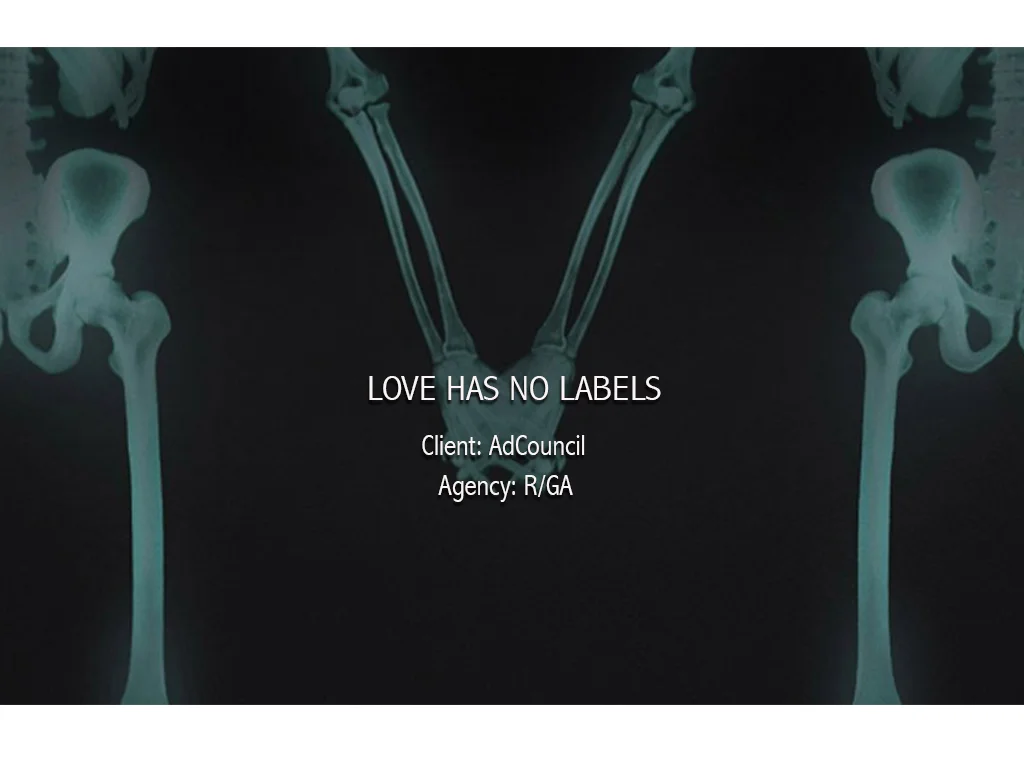 LOVE HAS NO LABELS