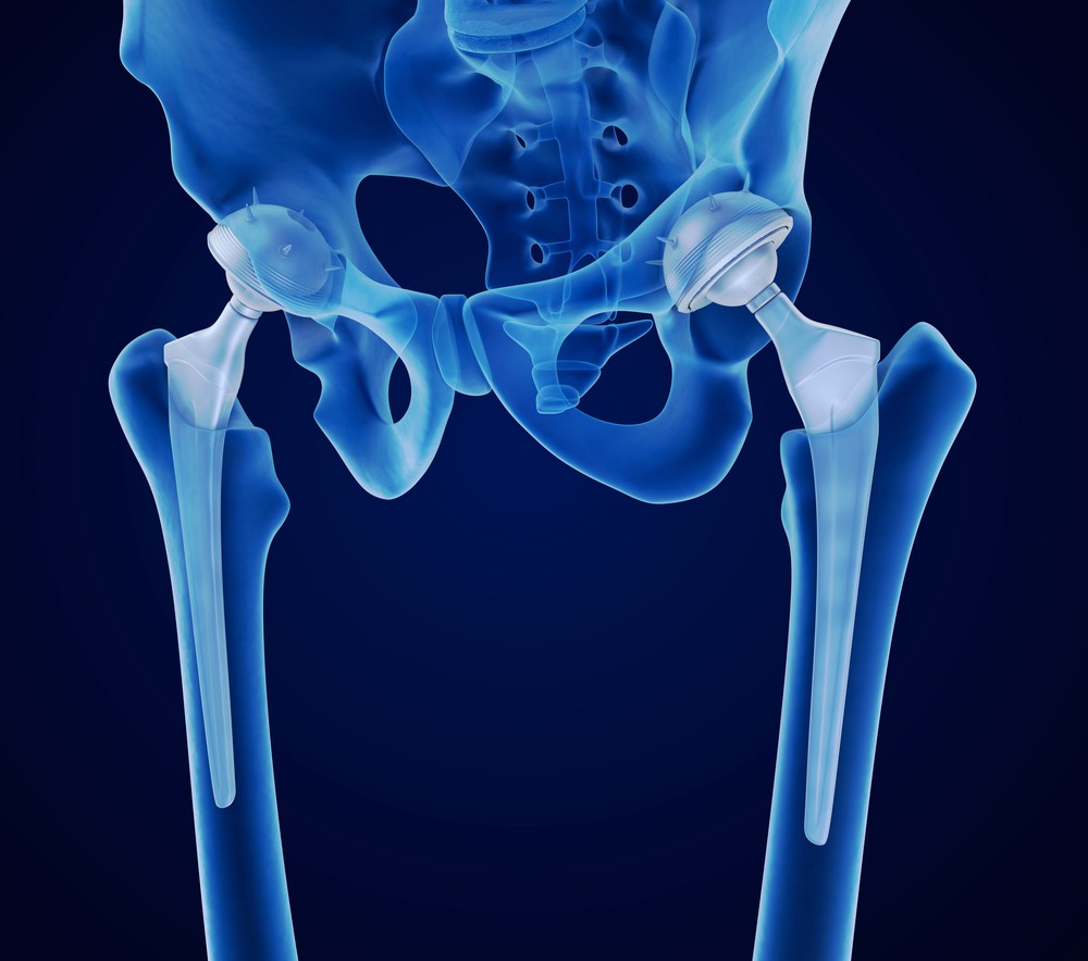 1_bone.jpeg