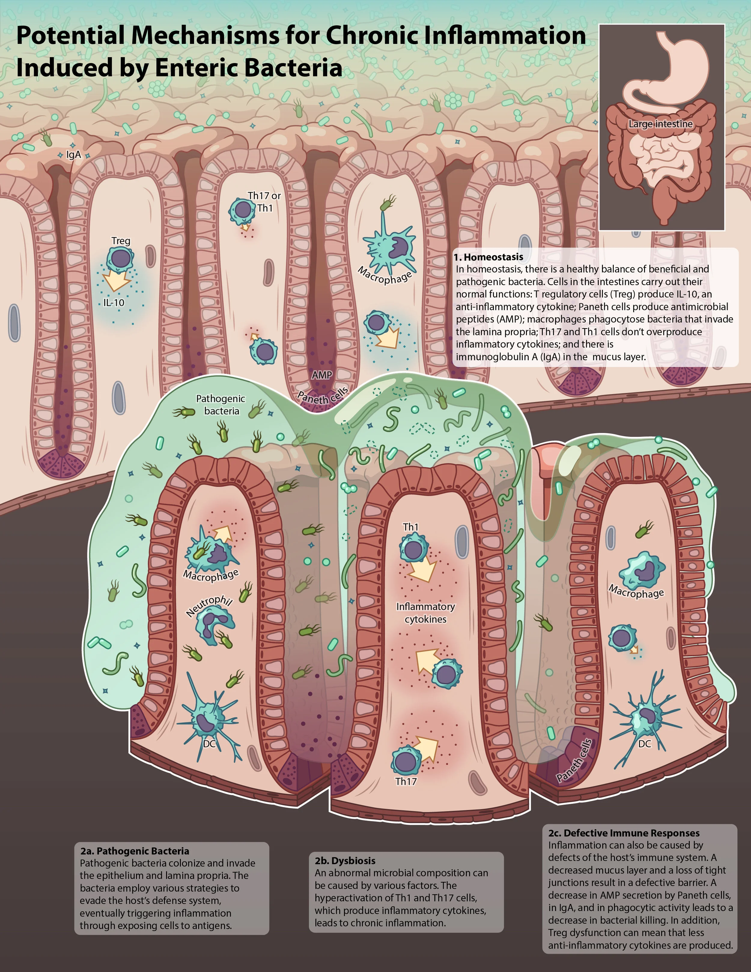 gut inflammation causes