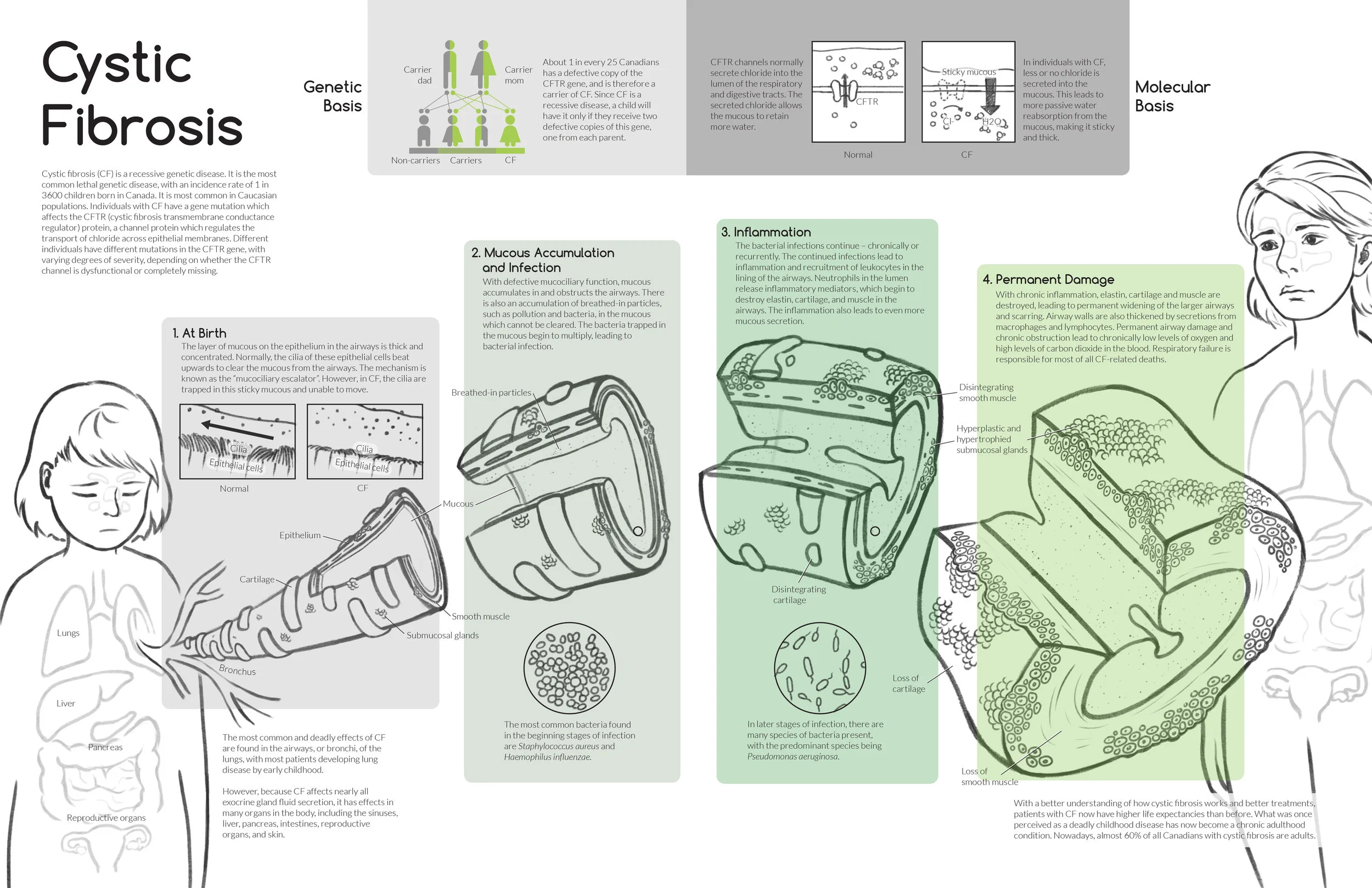 Cystic Fibrosis Layout 4-01.jpg