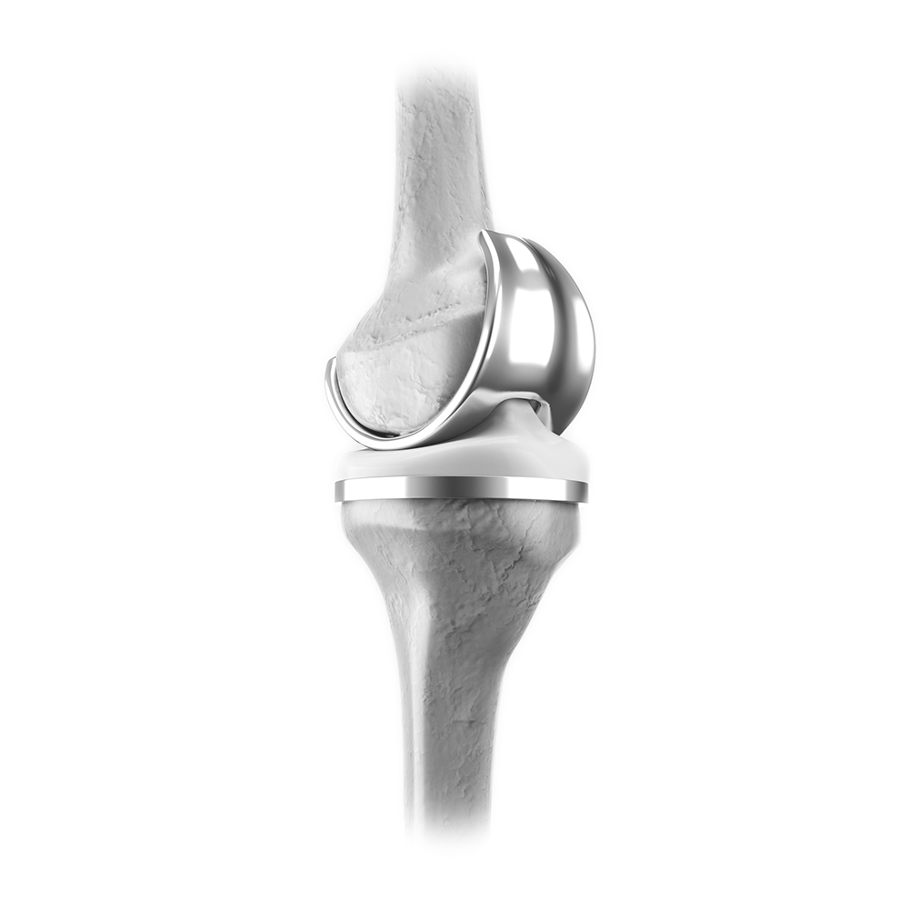 IMG_Knee_04.png