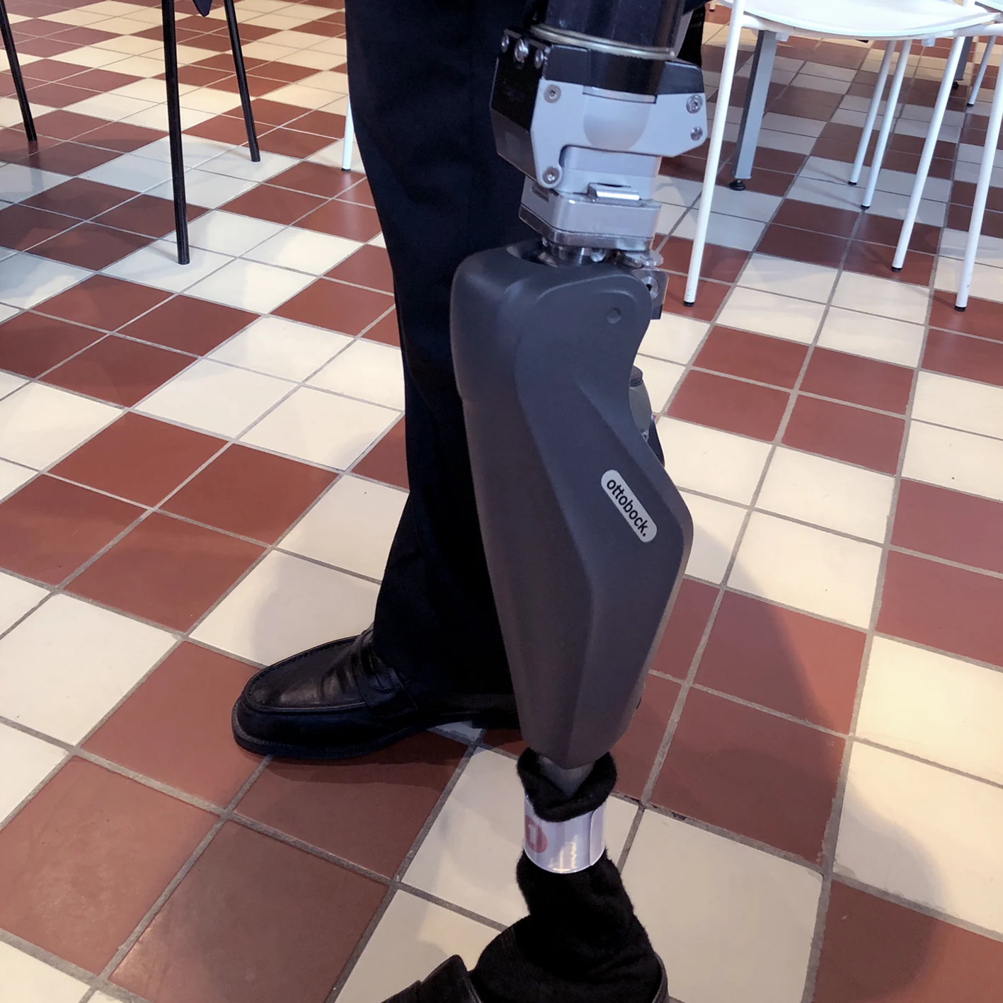 Copy of 2017: Erik's latest prosthesis