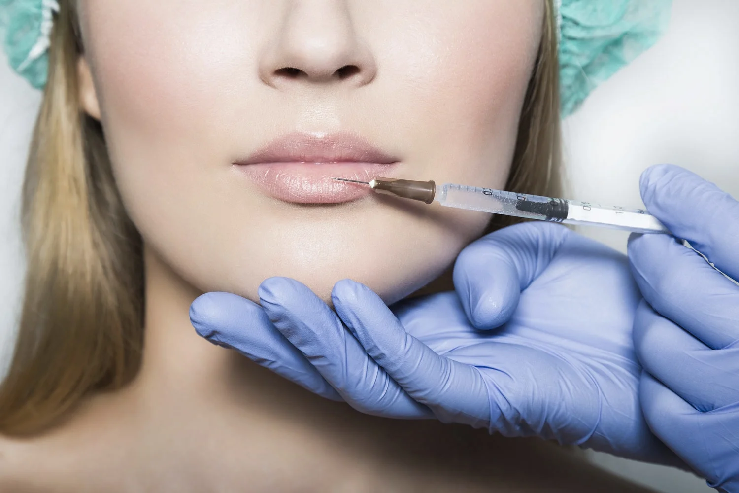 Lady having dermal fillers