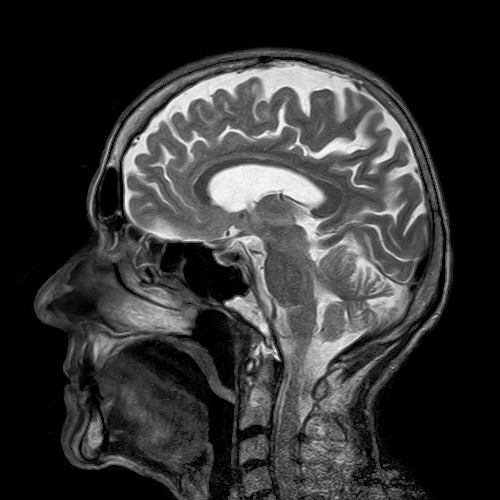 The Unique Brain with Dr. Kathleen Gates