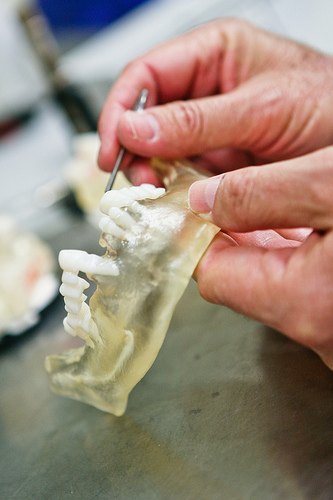 Same Day Teeth Procedure at International Congress of Oral Implantologists