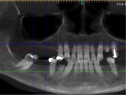 An Illuminating Story for Dentists