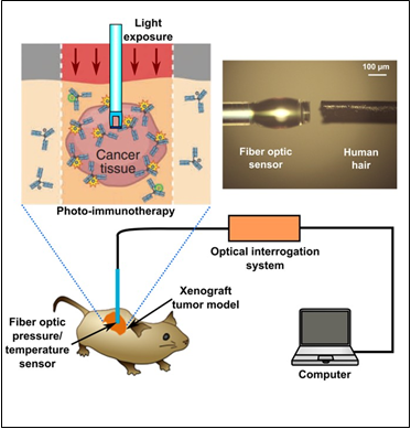 PIT is a molecular targeting cancer therapy with minimum side effects. PIT has been demonstrated to effectively treat cancer cells without damaging surrounding normal tissue. To better understand and optimize the effectiveness of this therapy, it is important to measure and study the change of physiological parameters (e.g. interstitial pressure, temperature, etc). This project will develop a miniature multifunctional fiber optic sensor, which provides a real-time monitoring tool to study and monitor PIT therapeutic effect in vivo.