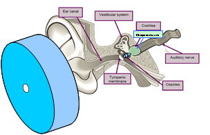 Ear diagram shows device placement, ear anatomy including the location of the cochlea, and the delivered otoprotectant (light green).