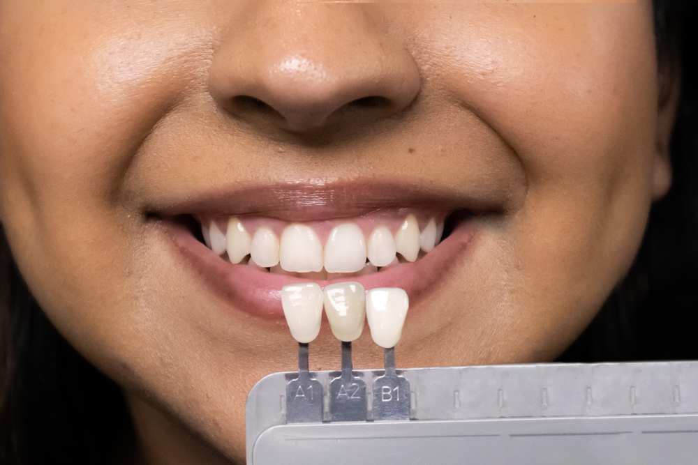 Lighting and Shade Protocol — Paramount Dental Studio