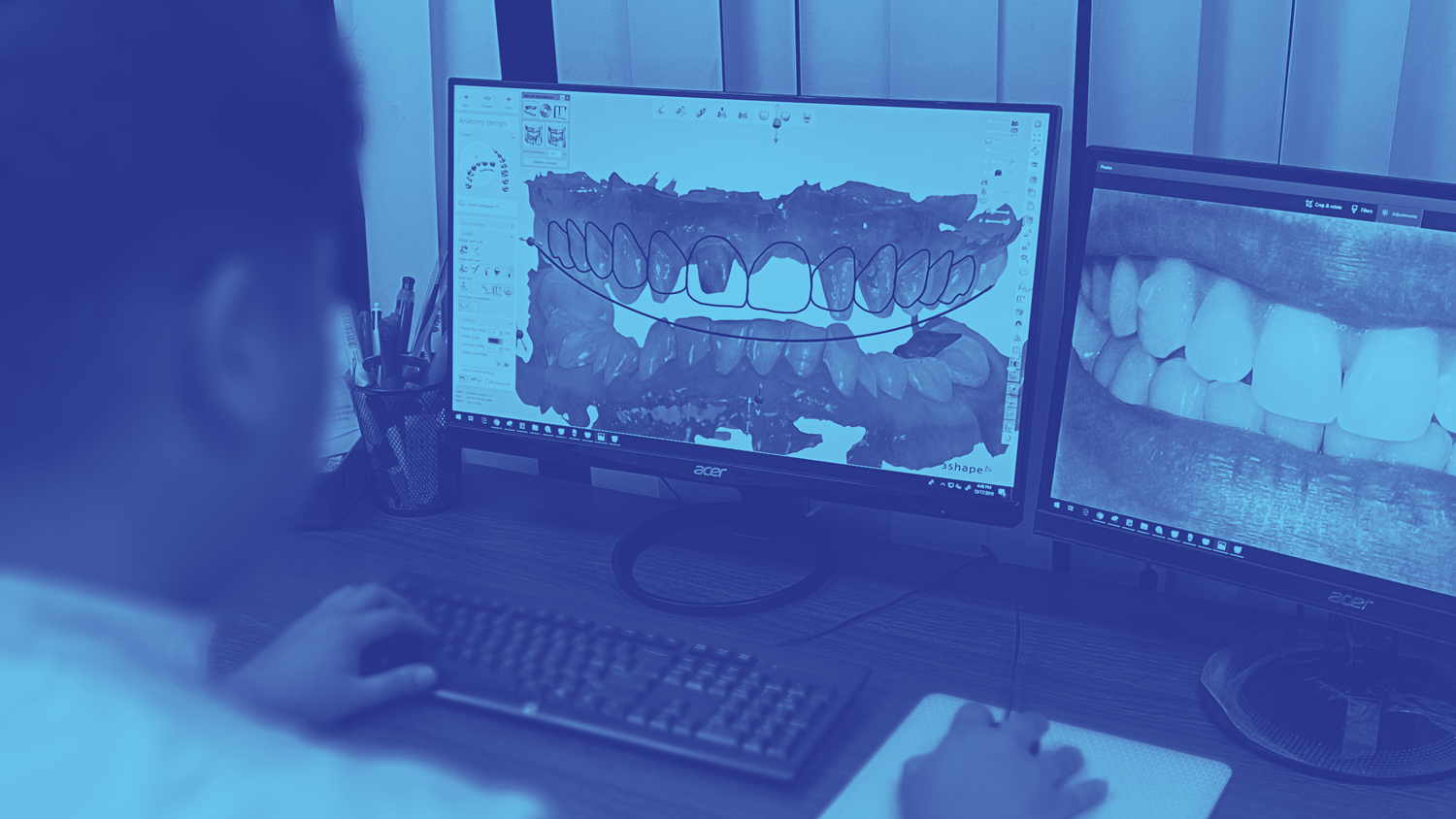 PDS_SmileDesign_Working_web.png