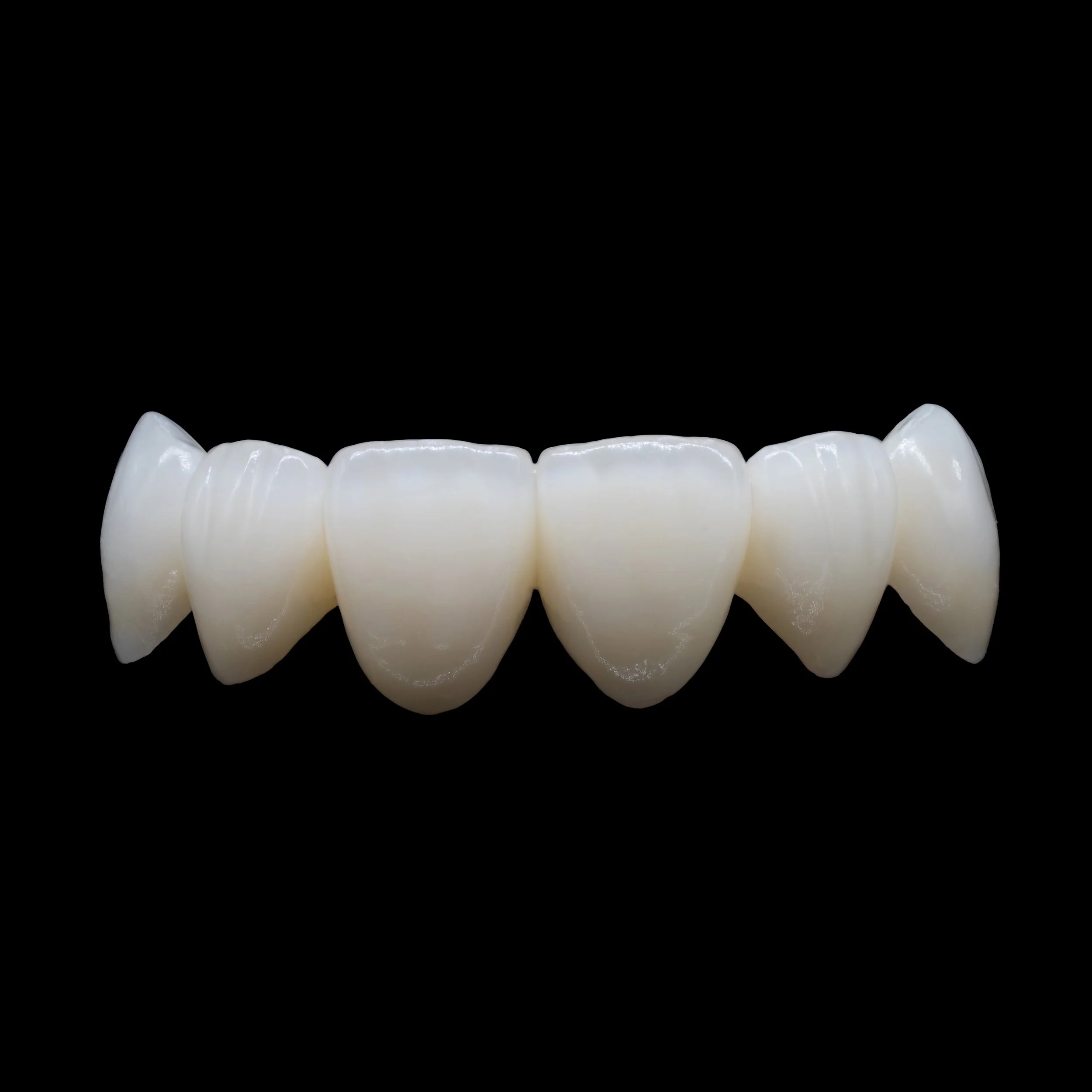 A2 Zirconia Monolithic 6-Unit Bridge