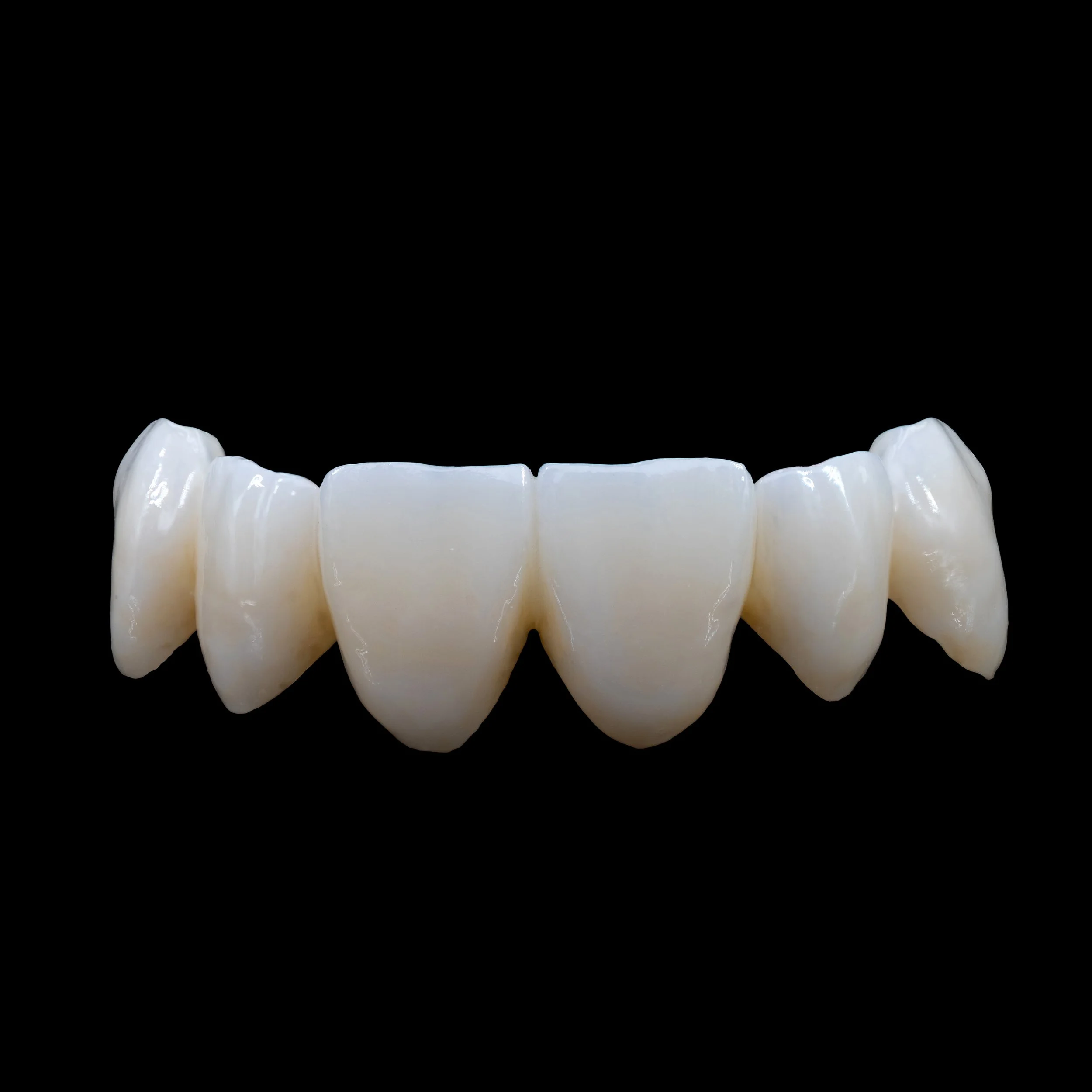 A2 Zirconia Bridge - Full Contour, No Layering