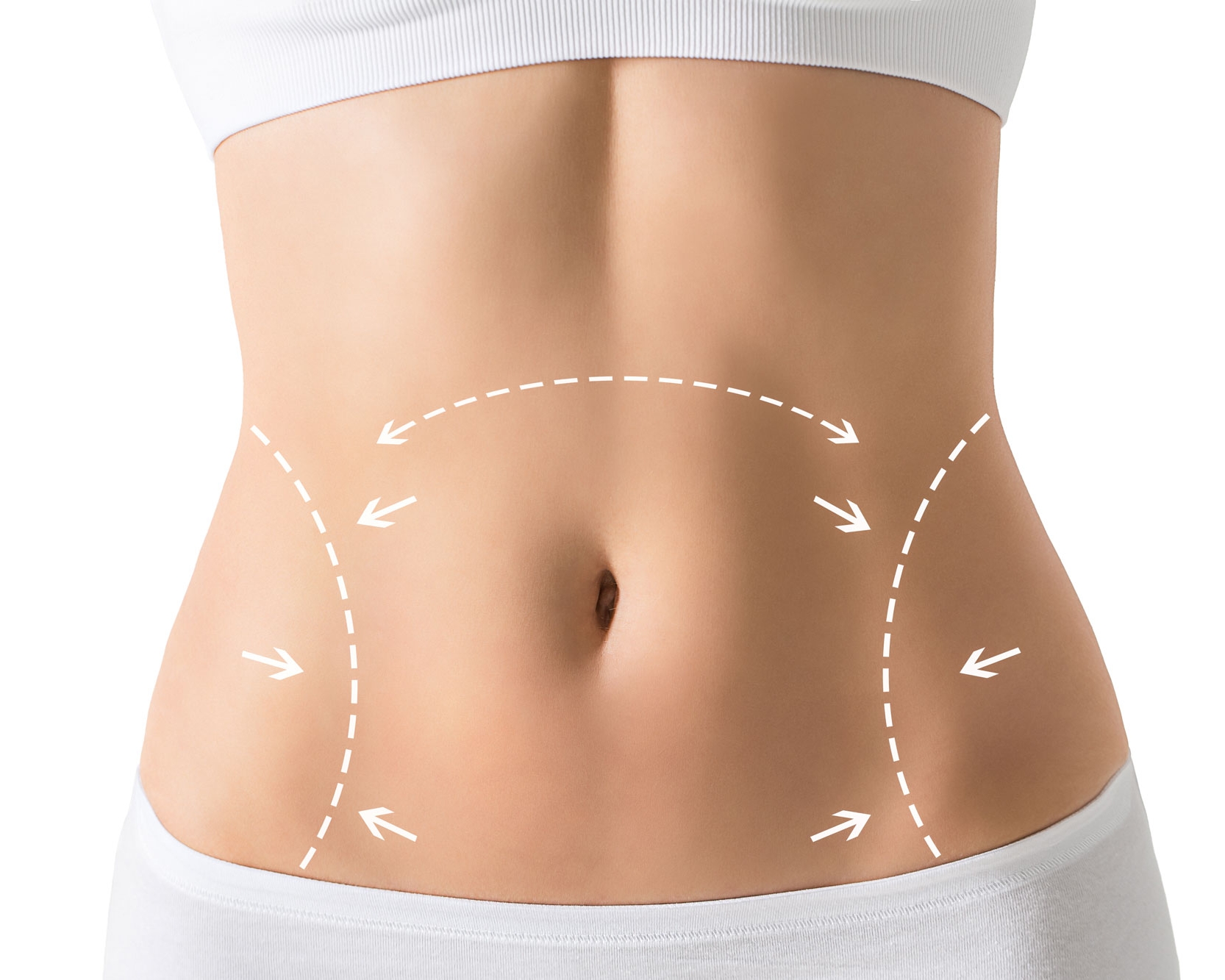 tummy-tuck-athens-ga-moore-center.jpg