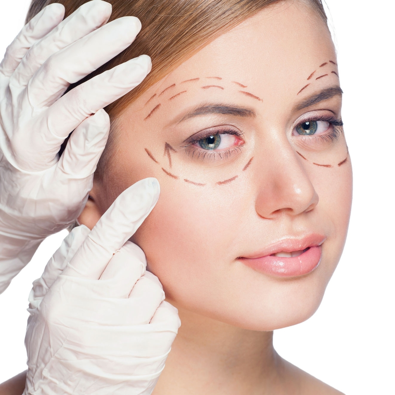 eye-brow-surgery-athens-ga-moore-center.jpg