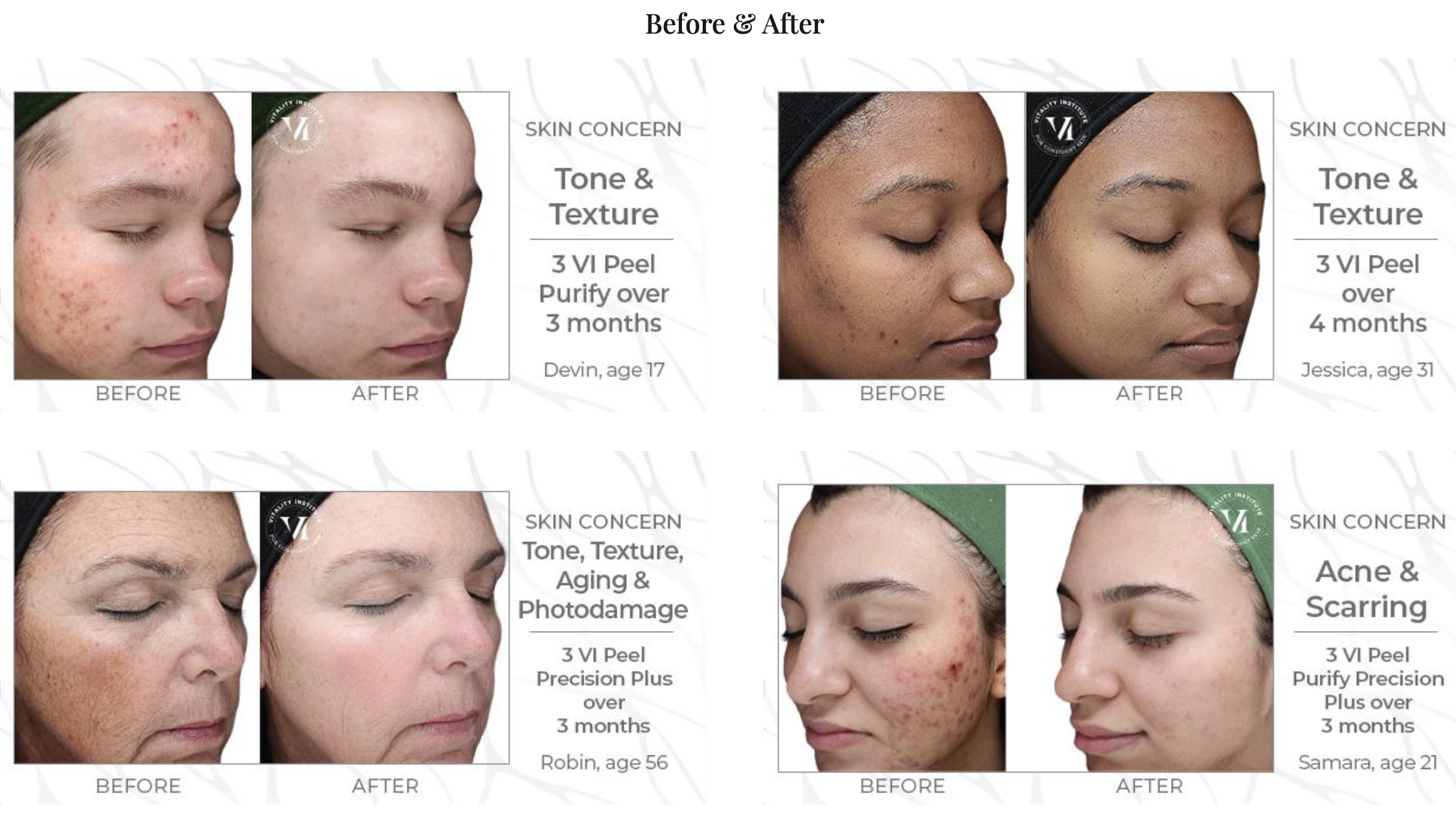 VI Peel Reveal Your Radiance The Moore Center — The Moore Center