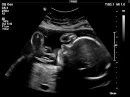 Congratulations and celebrations