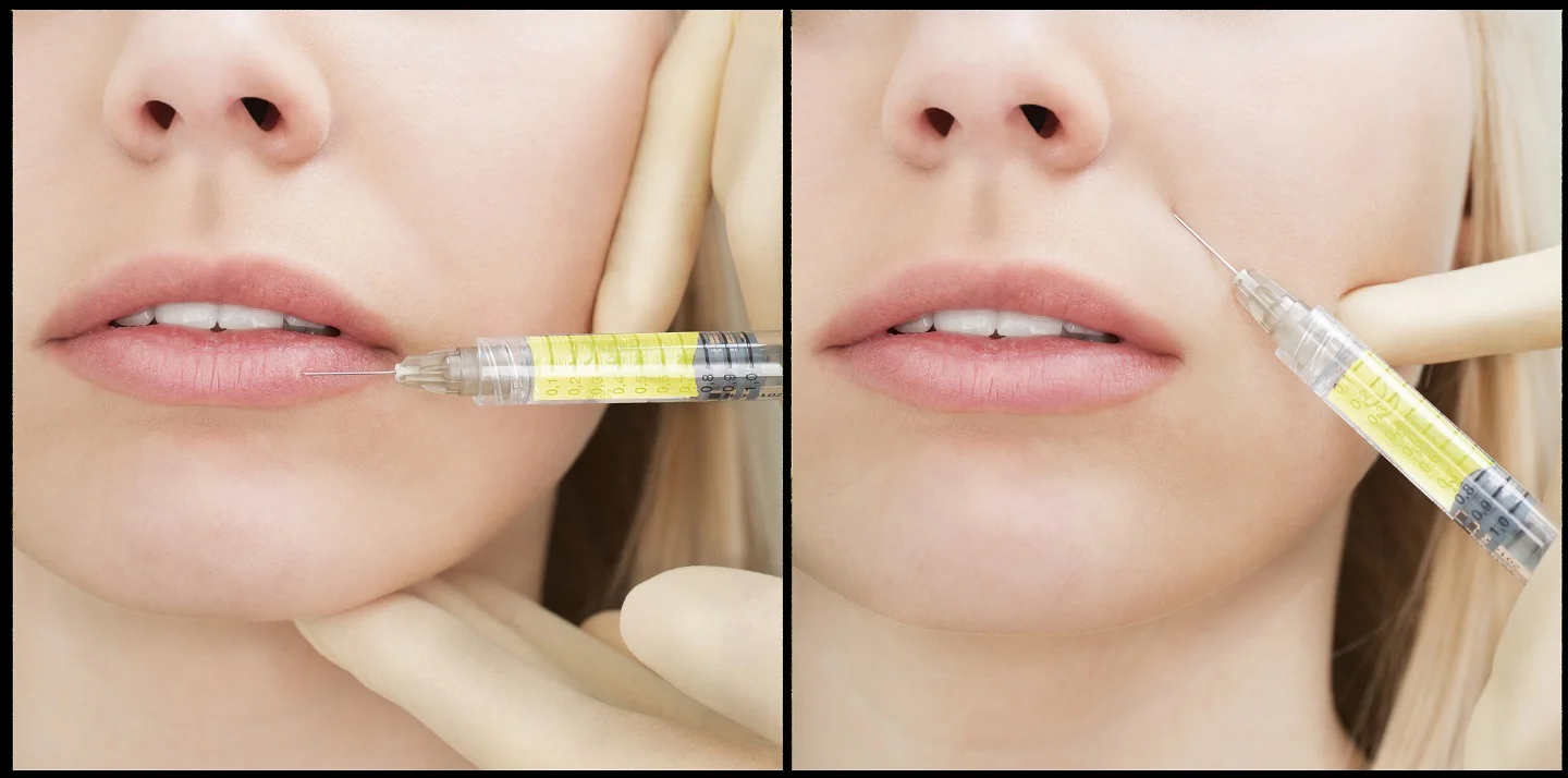 bio filler.jpg