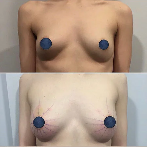 adipogen diana.jpg