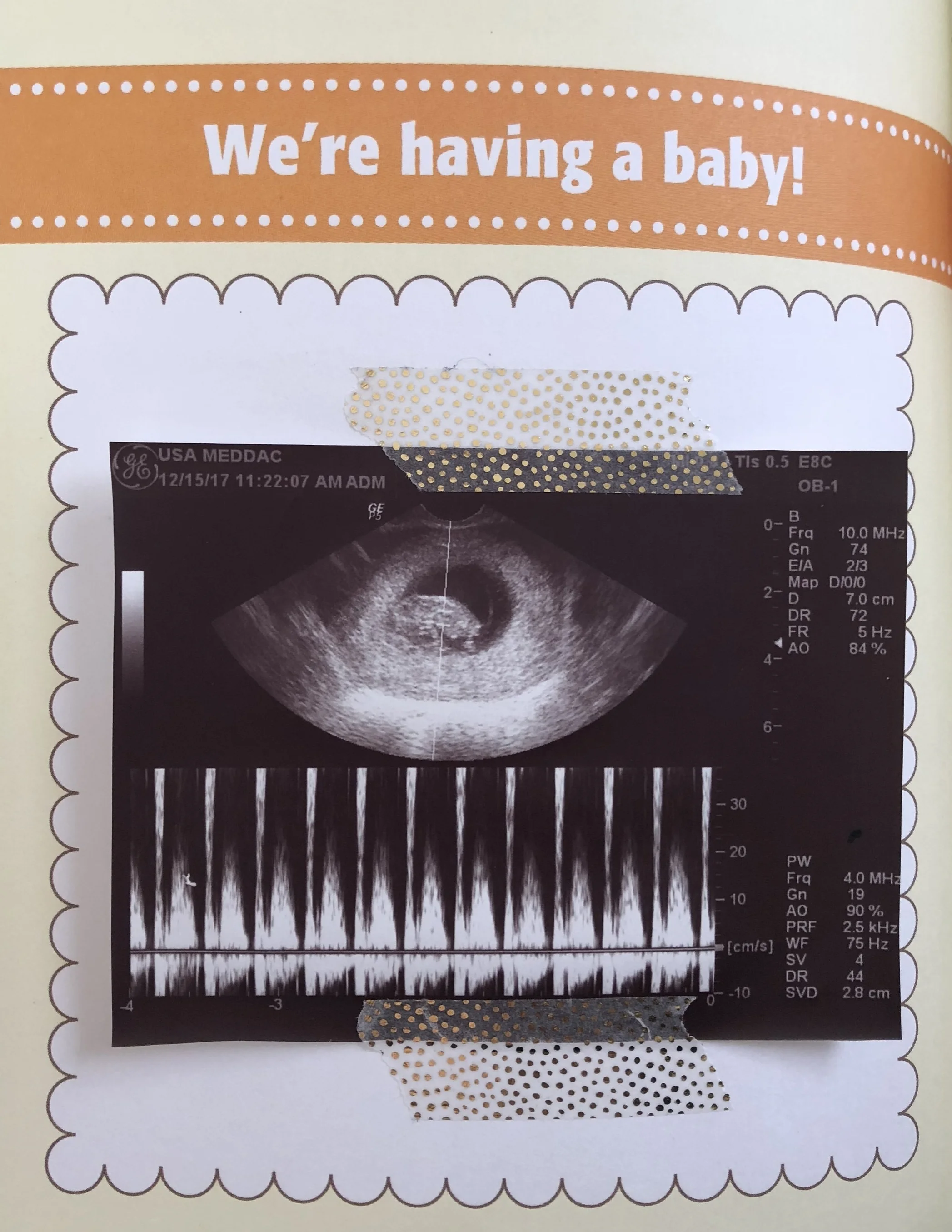 This is the first image that we ever saw of Baby Murphy. We were seven weeks pregnant and had no idea prior. Seeing this image was the greatest thing in the world. I cried like crazy. I was so anxious because Baby was leaning back in my uterus so th…