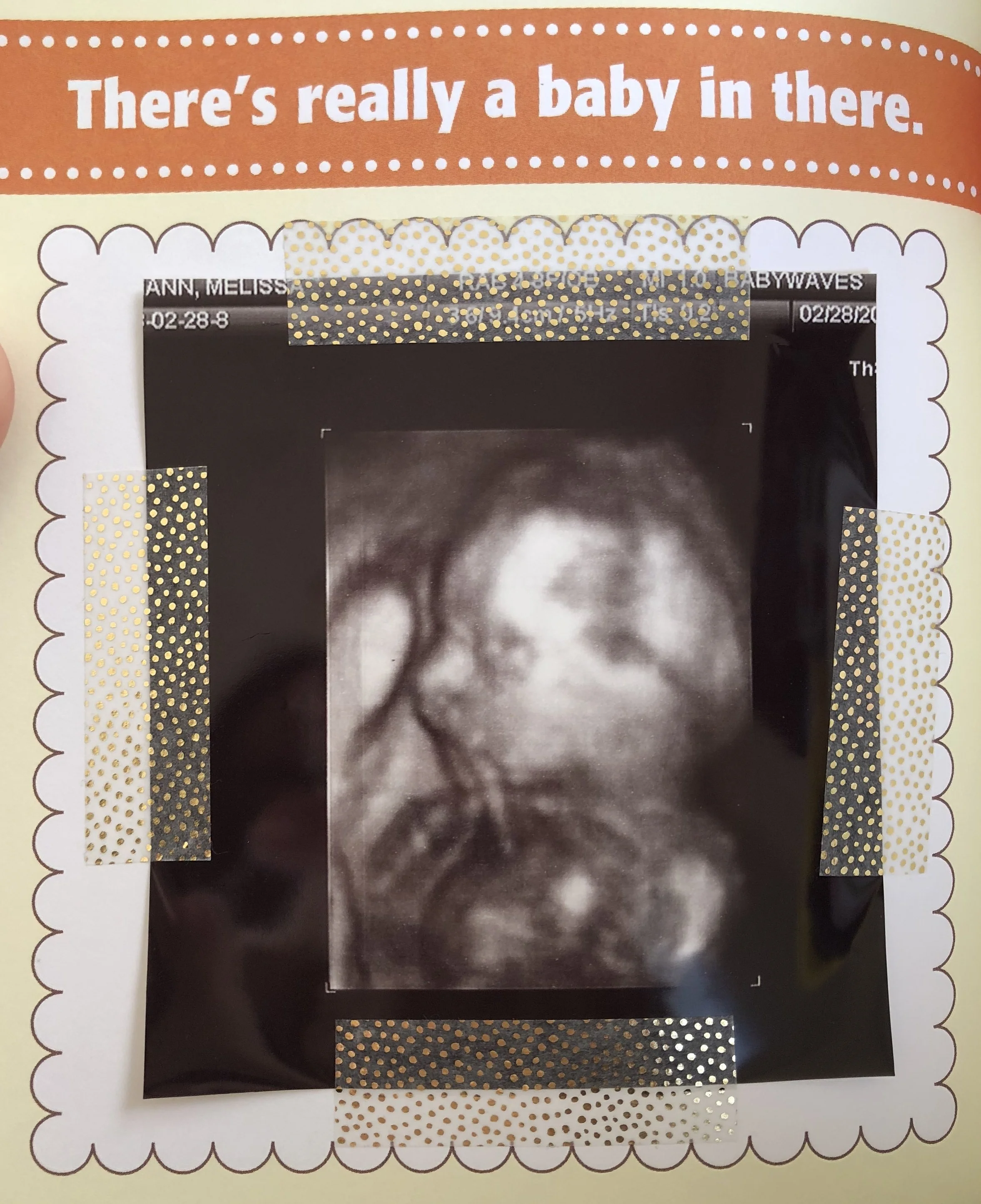 It's official! Baby Murphy is a GIRL!!!!