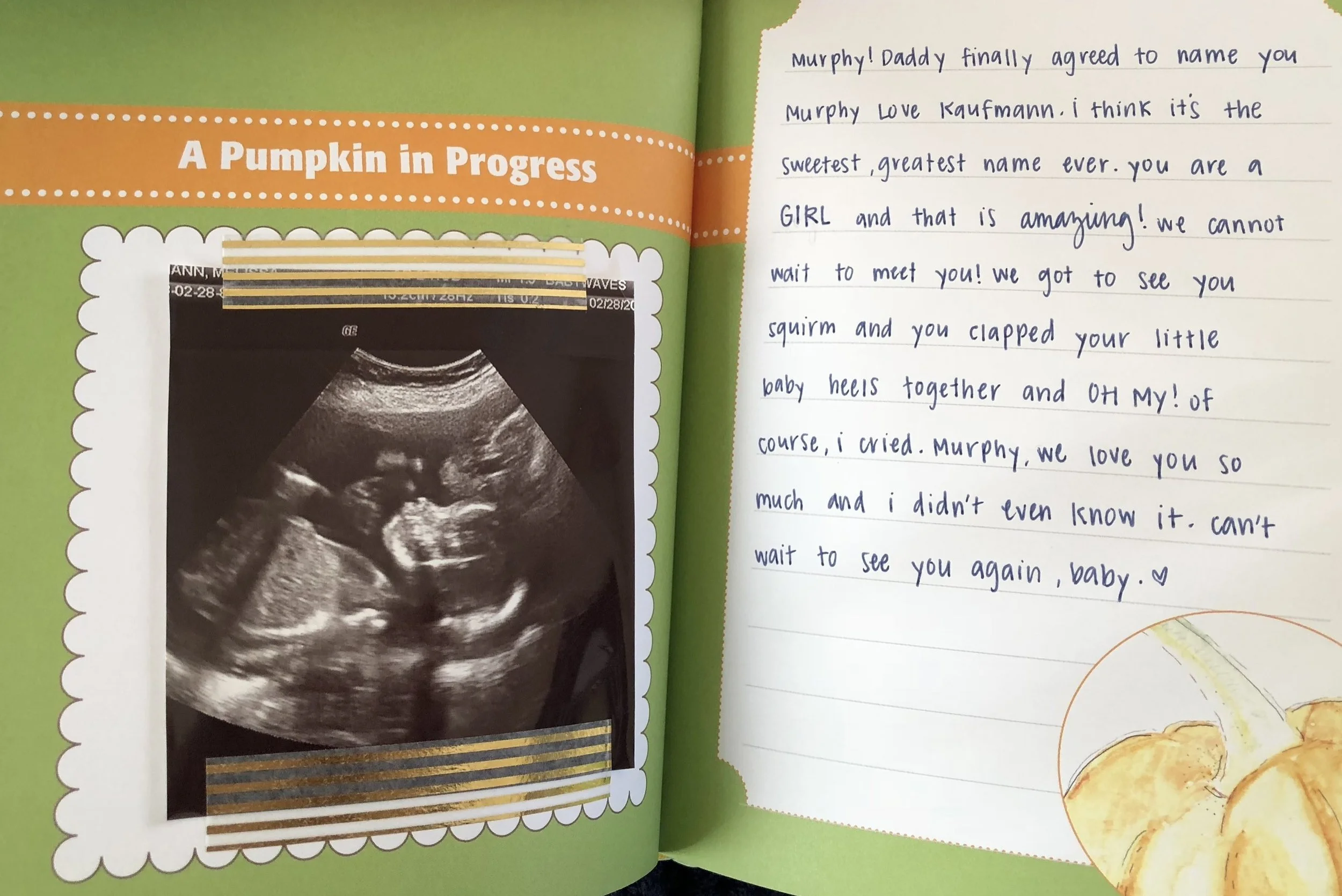 This was supposed to be our eighteen week update but we didn't have a picture of anything. This is a sonogram from our twenty week appointment from when we found out the gender. I just felt like we should let Murphy know how we felt.