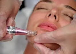 Exosome Facial