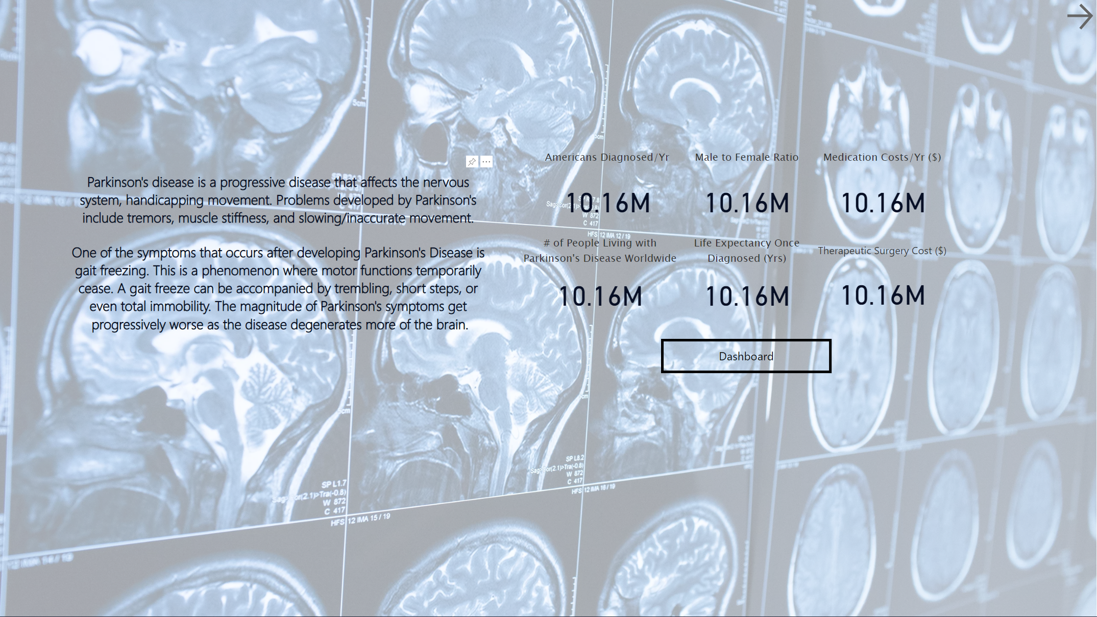 Visualizing Parkinson's Disease