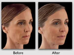 voluma2.jpg