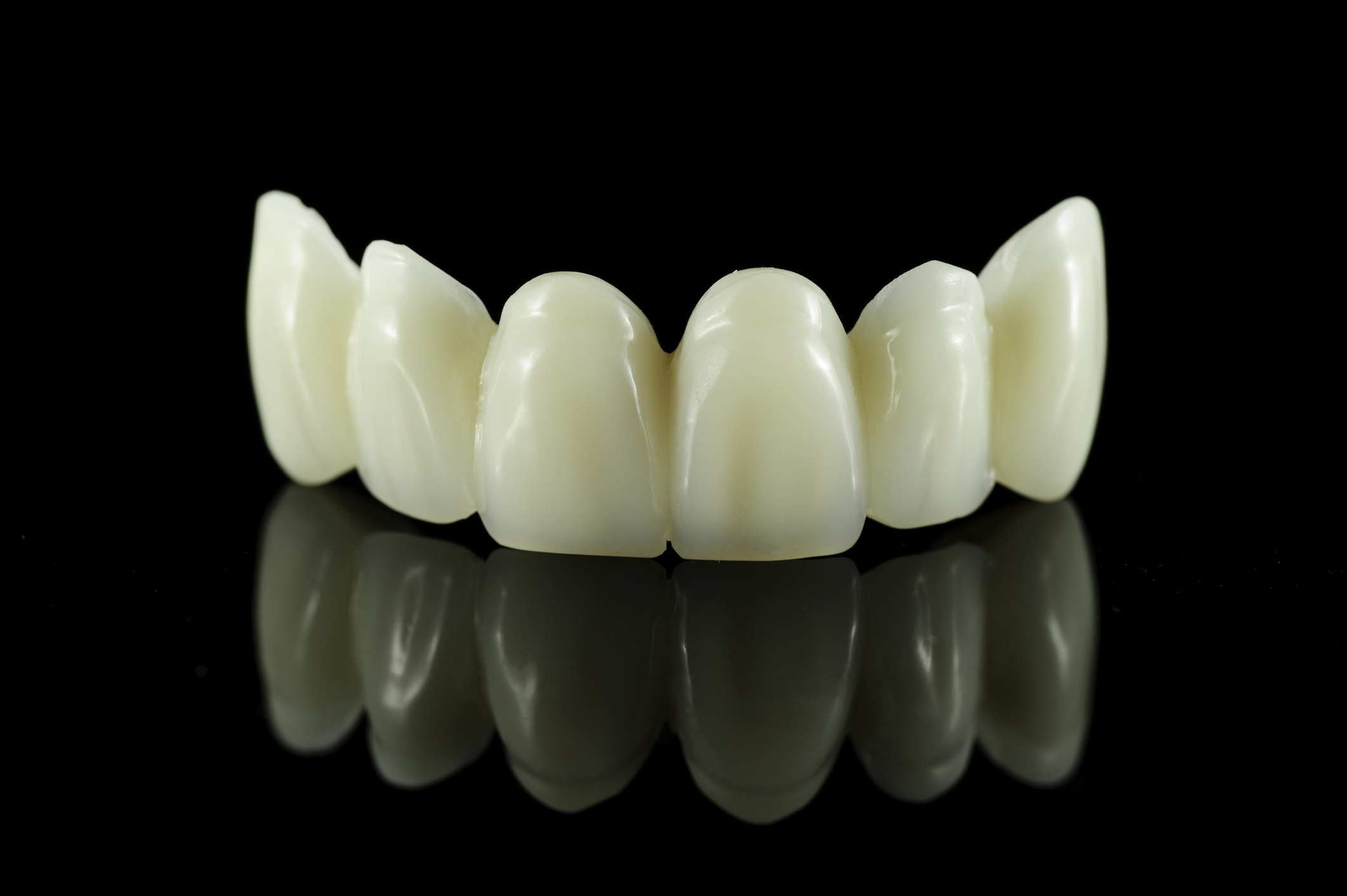 Here is an example of a Dental bridge. 
