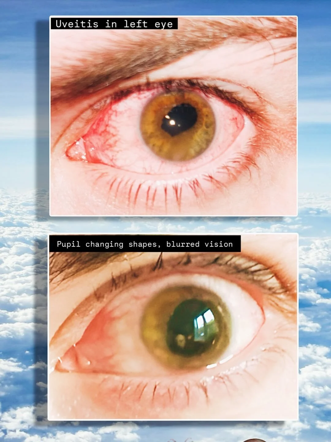 Did I already tell you about how my eye was all fucked up and not working properly? Yeah it&rsquo;s basically better now but that sucked...hm&hellip;it&rsquo;s getting cold&hellip;Rana is going to Turkey. Wow and speaking of cold+turkey&hellip;..I qu