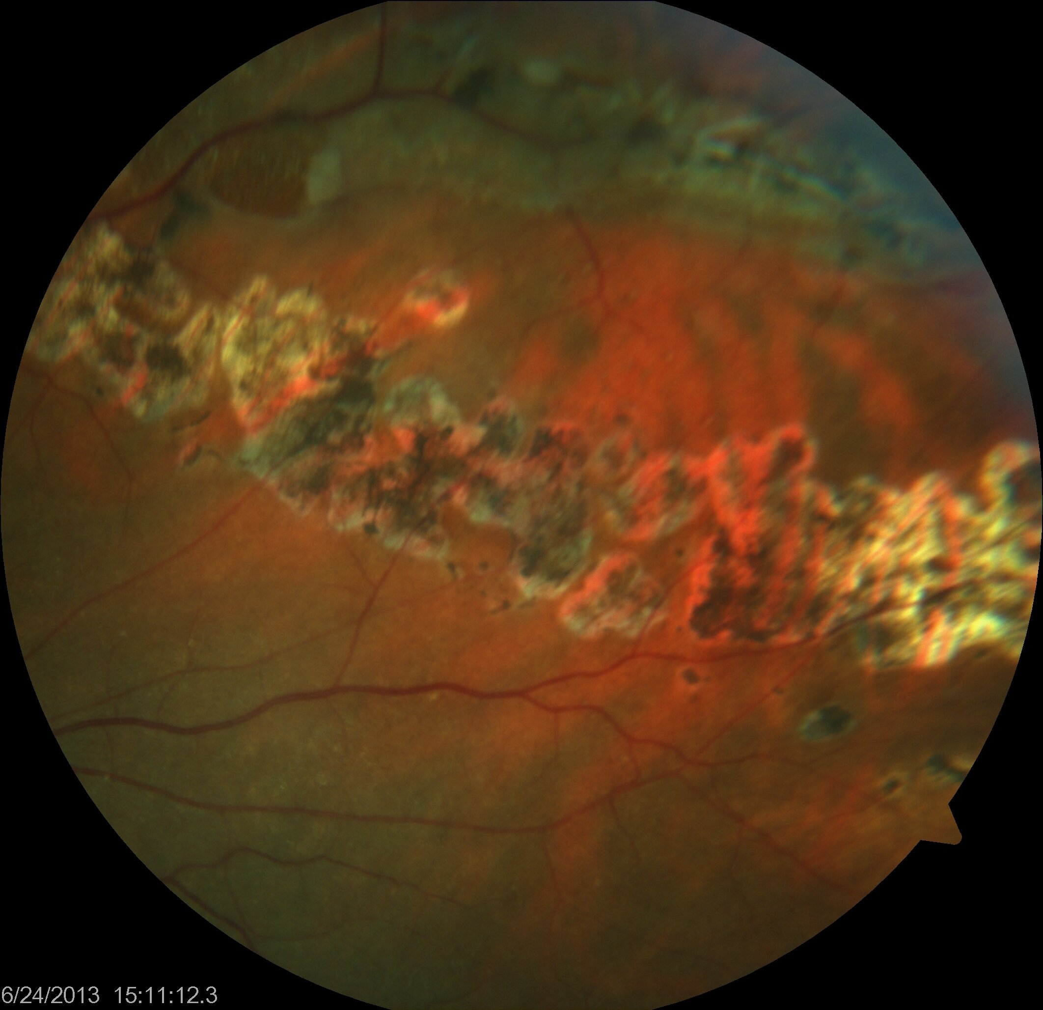 Lattice Degeneration