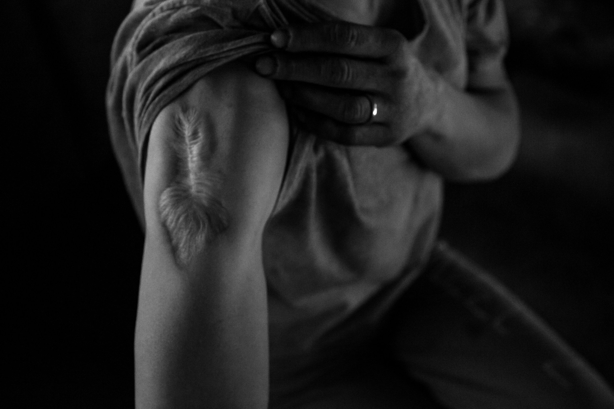  37-year-old Angie Ulrich pulls back her sleeve to show the scar from the abscess that was removed from her arm due to heroin use, Thursday, May 26, 2016. Ulrich as been on and off heroin, and in and out of the Jungle, over the last 15 years. 