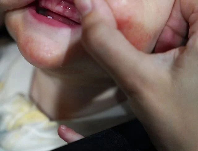 Anita at 9 months 5/6/2020