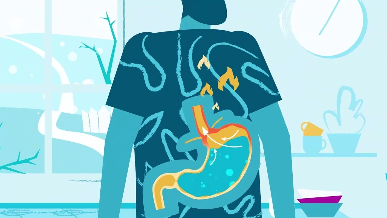 Quale dieta contro il reflusso gastrico? (Immagine Thanks to patient.gastro.org )