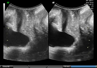 fig 6 1-2 img-op.jpg