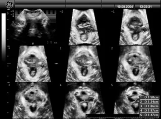 fig 2 3D-4D Ultrasound.jpg