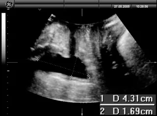other pathology fig 3.jpg