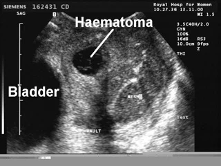 other pathology fig 4.jpg