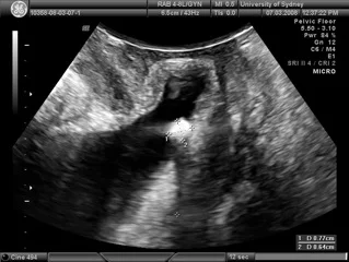 other pathology fig 9.jpg
