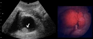 other pathology fig 10.jpg