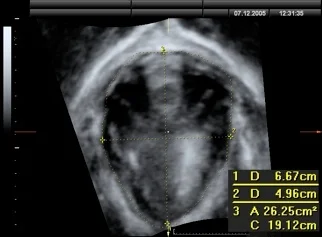 Levator Biomechanics fig 2.jpg